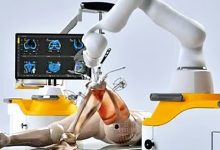 knee replacement surgery voice of eastern