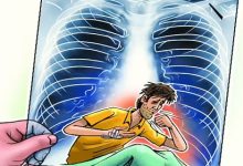 क्षयरोग मुक्त भारत अभियान voice of eastern